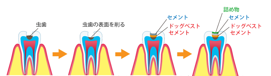 ドックベスト療法の治療の手順